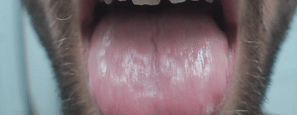 Electrospun fibers instantly dissolving on human tongue